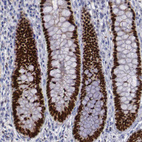 Anti-SATB2 Antibody