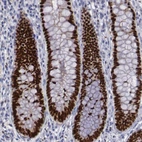 Immunohistochemical staining of human rectum shows strong nuclear positivity in glandular cells.