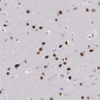 Immunohistochemical staining of human cerebral cortex shows strong nuclear positivity in neurons.