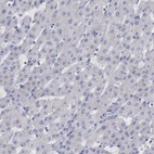 Immunohistochemical staining of human liver shows no positivity in hepatocytes as expected.