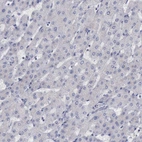 Immunohistochemical staining of human liver shows no positivity in hepatocytes as expected.