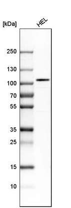 Western blot analysis in human cell line HEL.