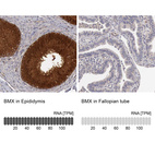 Anti-BMX Antibody