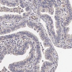 Immunohistochemical staining of human fallopian tube shows low expression as expected.
