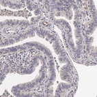 Immunohistochemical staining of human fallopian tube shows low expression as expected.