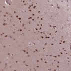 Anti-ZNF630 Antibody