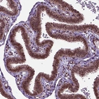 Immunohistochemical staining of human fallopian tube shows strong nuclear positivity in glandular cells.