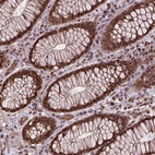 Immunohistochemical staining of human rectum shows strong nuclear positivity in glandular cells.