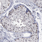 Anti-BRD1 Antibody