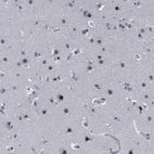 Immunohistochemical staining of human cerebral cortex shows moderate to strong nuclear positivity in neurons.