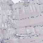 Immunohistochemical staining of human skeletal muscle shows no positivity in myocytes as expected.