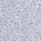 Anti-BRD1 Antibody