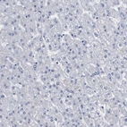 Immunohistochemical staining of human liver shows no positivity in hepatocytes as expected.