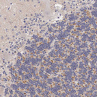 Anti-KCND1 Antibody