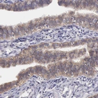 Immunohistochemical staining of human fallopian tube shows strong membranous positivity in glandular cells.