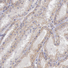 Anti-KCND1 Antibody