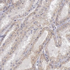 Immunohistochemical staining of human kidney shows moderate membranous positivity in cells in tubules.