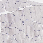 Immunohistochemical staining of human skeletal muscle shows no positivity in myocytes as expected.