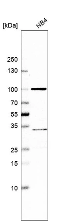Western blot analysis in human cell line NB4.