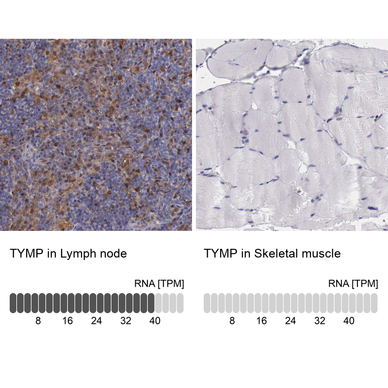 Anti-TYMP Antibody