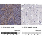 Anti-TYMP Antibody