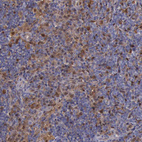 Anti-TYMP Antibody