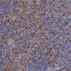 Immunohistochemical staining of human lymph node shows moderate cytoplasmic positivity in lymphoid cells.