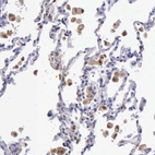 Anti-TYMP Antibody