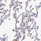 Immunohistochemical staining of human lung shows moderate cytoplasmic positivity in macrophages.
