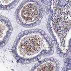Immunohistochemical staining of human small intestine shows moderate cytoplasmic positivity in lymphoid cells.