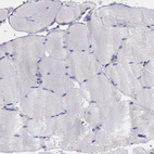 Immunohistochemical staining of human skeletal muscle shows no positivity in myocytes as expected.