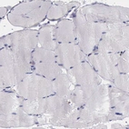 Immunohistochemical staining of human skeletal muscle shows no positivity in myocytes as expected.