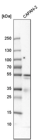 Western blot analysis in human cell line CAPAN-2.