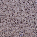 Anti-TRMT2A Antibody