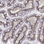 Immunohistochemical staining of human small intestine shows moderate nuclear positivity in glandular cells.