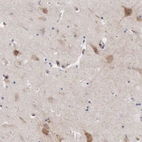 Immunohistochemical staining of human hippocampus shows moderate cytoplasmic positivity in neuronal cells.