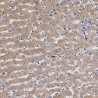 Immunohistochemical staining of human liver shows moderate cytoplasmic positivity in hepatocytes.