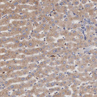 Anti-APOL2 Antibody