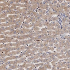 Immunohistochemical staining of human liver shows moderate cytoplasmic positivity in hepatocytes.