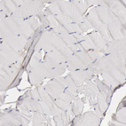 Immunohistochemical staining of human skeletal muscle shows no positivity in myocytes as expected.