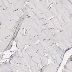 Immunohistochemical staining of human skeletal muscle shows no positivity in myocytes as expected.