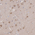 Immunohistochemical staining of human cerebral cortex shows moderate cytoplasmic positivity in neuronal cells.