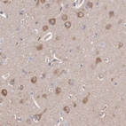 Immunohistochemical staining of human cerebral cortex shows moderate cytoplasmic positivity in neuronal cells.