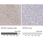 Anti-NPTXR Antibody