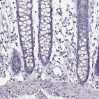 Anti-NPTXR Antibody