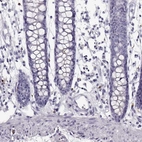 Immunohistochemical staining of human colon shows no positivity in glandular cells as expected.