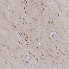 Anti-NPTXR Antibody