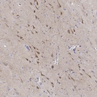 Immunohistochemical staining of human cerebral cortex shows moderate cytoplasmic positivity in a subset of neurons.