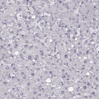 Immunohistochemical staining of human liver shows no positivity in hepatocytes as expected.