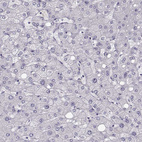 Anti-NPTXR Antibody